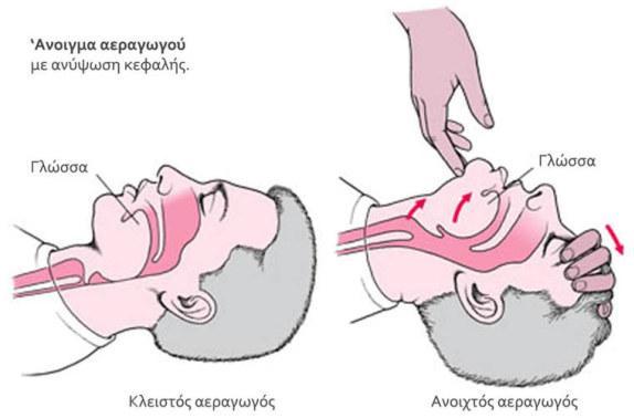 ΑΝΤΙΜΕΤΩΠΙΣΗ - ΠΡΩΤΕΣ ΒΟΗΘΕΙΕΣ Καλούμε αμέσως ιατρική βοήθεια. Βάλτε τον άρρωστο να ξαπλώσει, έχοντας το σημείο που έχει υποστεί το τσίμπημα πιο χαμηλά από την καρδιά και κατά το δυνατόν ακίνητο.