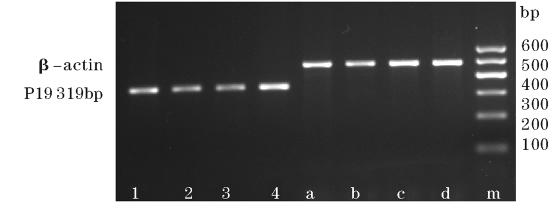 05 3 P19 1. 4 Western AnnexinA2 P19 β - actin 0. 28 ± 0. 13 0. 78 ± 0. 21 p19 P < 0.