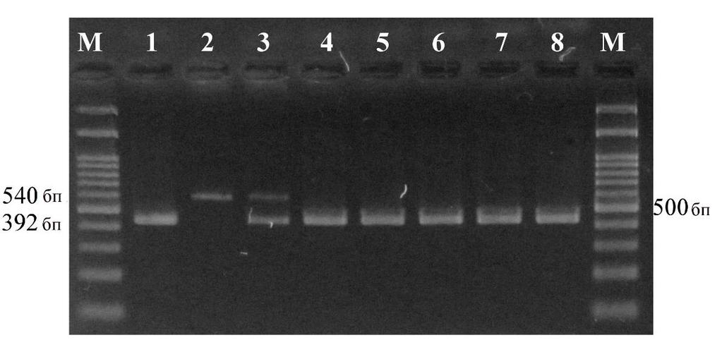 Слика 3. Приказ резултата PCR методе за детекцију свих врста родова Theileria и Babesia.