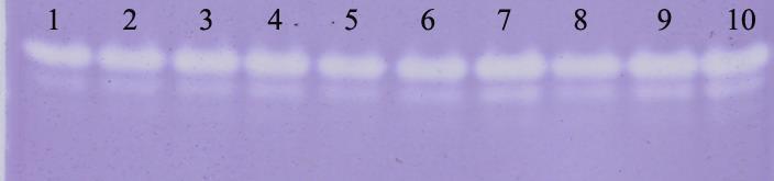 SOD1 a SOD1 b Densitometry (arbitrary units/g Hb) Слика 6 5. SOD1 електроферограм на полиакриламидном гелу (1-5: коњи из контролне групе; * 6-10: коњи инфицирани са T.