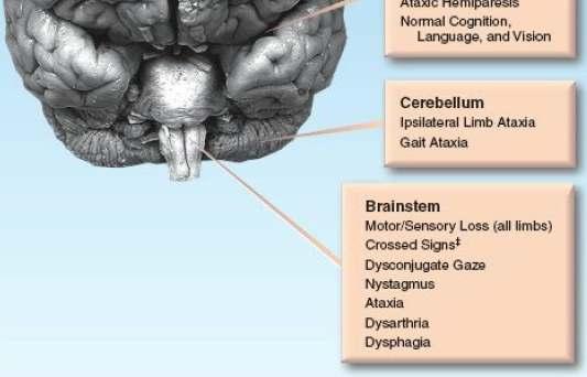 no loss of consciousness When accompanied by coma: