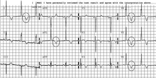 voltage criteria for
