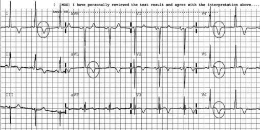 voltage criteria for