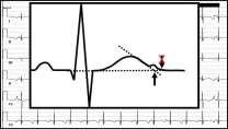 Curr Probl Cardiol