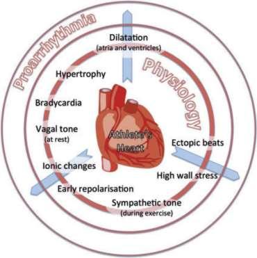 develop arrhythmias La Gerche A,