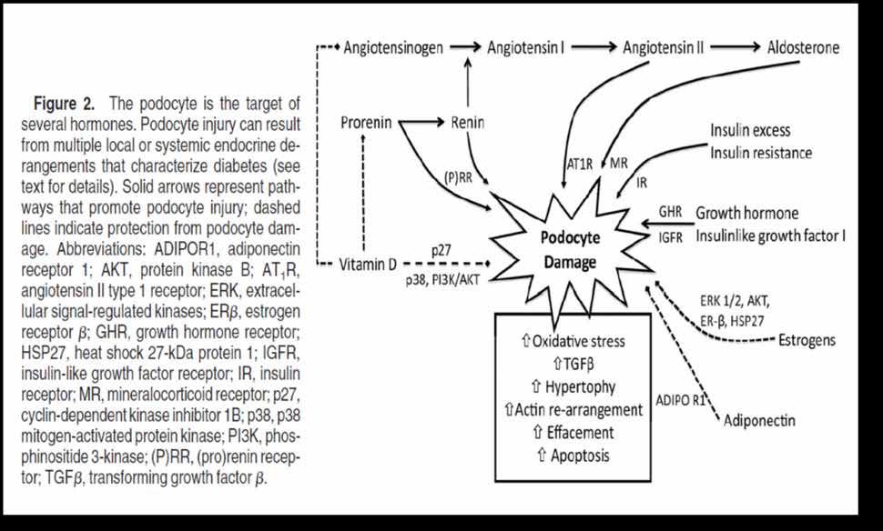 podocytes involving