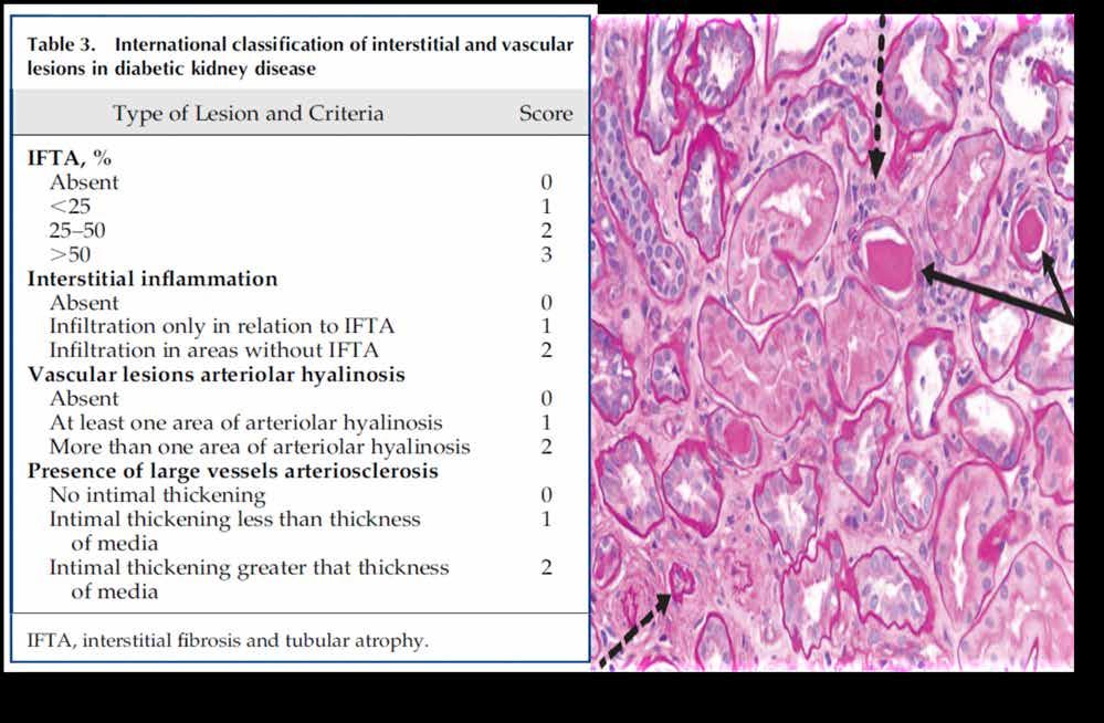 Am Soc Nephrol.