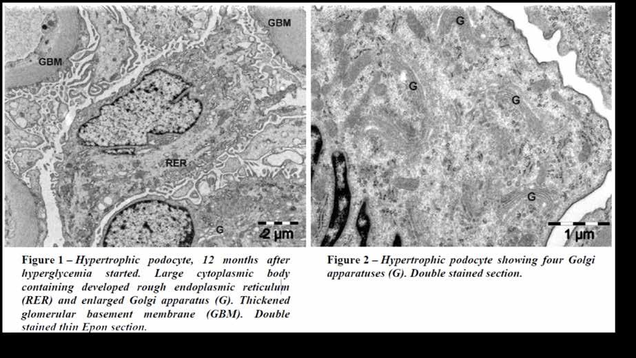 Rom J Morphol Embryol 2012, 53(1):23