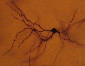 Κερκοφόρος Πυρήνας Medium-sized spiny neurons 97% του κυτταρικού πληθυσµού