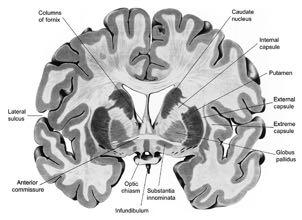 Putamen The putamen lies medial to the insula bounded laterally by the external capsule medially by the globus pallidus.
