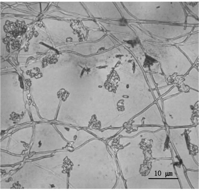 PBS ph 7 7 SF4 PDA 1 mg ml -1 25 7 d 20 μg ml - 1 25 ~ 35 mm AChE 1 2 6 AChE G L Ellman 16 17 I I = OD - OD 1 100% OD 1 2 7 1 2 8% 14 18 PDB SDB CB 25