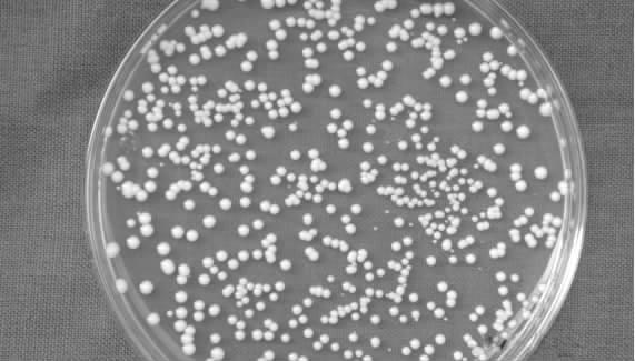 9 T 3 T Fig The colonial morphologic characteristics of T ( 5) Fig3 Individual under microscope of T (microscope photo 5) 5 5 35 3 5 5 5 5 5 3 35 Contain amount of glucose W/V / % 7