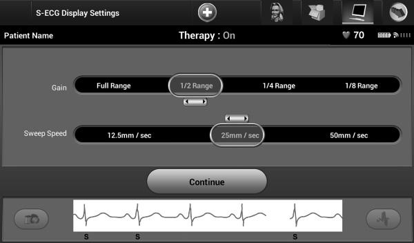 Nastavenia mierky S-EKG PROGRAMÁTOR Q-TECH : PREVÁDZKA Pre úpravu amplitúdy S-EKG v reálnom čase a pre zobrazenie možností nastavenia rýchlosti posunu: 1.
