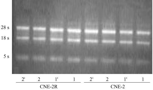 2011 4 31 2 Chin J Radiol Med Prot April 2011 Vol. 31 No. 2 169 P < 0. 051 CNE-2R CNE-2 1 1 CNE-2R CNE-2 α Gy - 1 β Gy - 2 α / β SF 2 CNE-2 0. 537 0. 024 22. 375 0. 310 CNE-2R 0. 166 0. 048 3. 458 0.