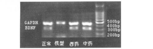 8 0 7 6.. 3 3 4 / 5 / 5-HT DA NE Glu GABA Gly 3 x 珋 ± s g /4h / g/kg 8 93. ± 5. 30 8. ± 3. 7 0. 3 ± 5. 8 3. 7 ± 5. 63 9 49. 4 ± 7. 68 ** 6. 7 ± 5. 00 ** 66. ± 9. 93 ** 3. ±. 3 ** 0. 05 0 60. 5 ± 8.