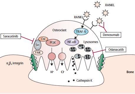 anti-rankl: DENOSUMAB RHEUMATOLOGY, HOCHBERG