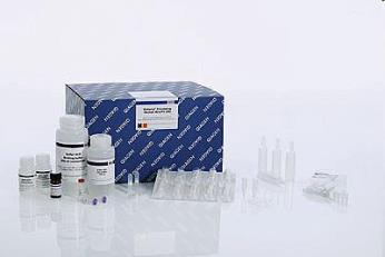 Viral RNA Qiagen