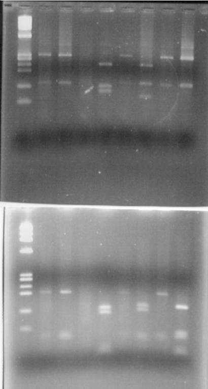 Περιβαλλοντικά μυκοβακτηρίδια που έχουν ανιχνευτεί στο νερό Upper Gel: PCR products digested by BstEII Bottom Gel: PCR products digested by HaeIII Lane 1: Marker φx174