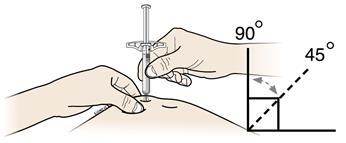 Βήμα 3: Ένεση (Ζ) Καθώς κρατάτε το δέρμα σας ανασηκωμένο, εισαγάγετε τη βελόνα της σύριγγας στο