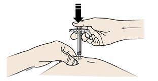 Μην ακουμπάτε το δάκτυλό σας στο έμβολο όταν εισάγετε την βελόνα.