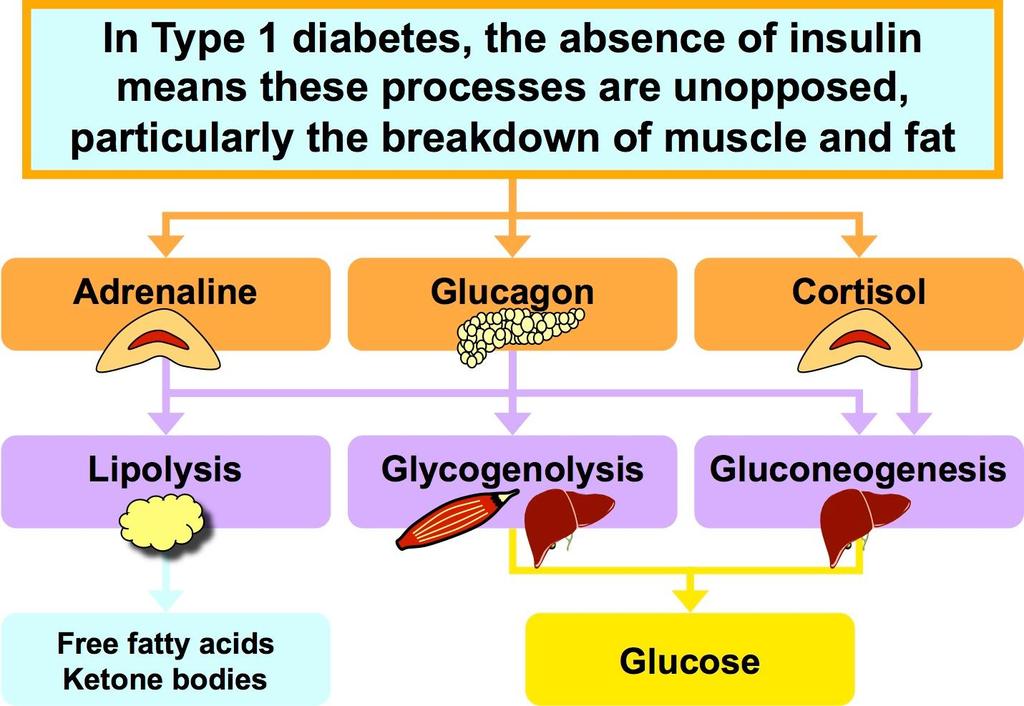 Η έλλειψη ινσουλίνης οδηγεί σε αύξηση των ορμονών του stress και