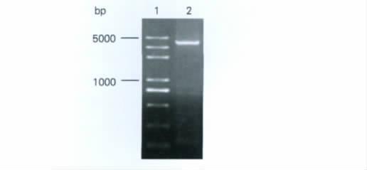 2012 2 36 2 Mil Med Sci Vol 36 No 2 Feb 2012 135 Her2 /neu cdna
