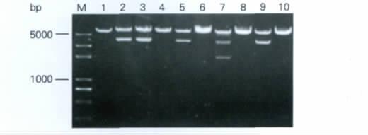 PCR neu 2 HER2neu 5 PCR pcdna3.