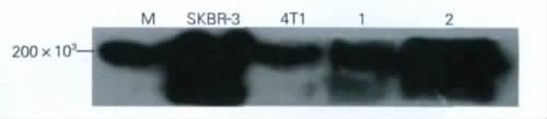 1-HYGRO-EGFP- neu 4T1-Luc GFP GFP 100% 6 HER2 /neu-gfp 4T1- Luc-