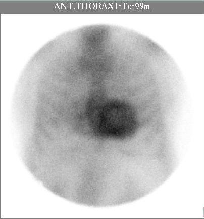 74 y M