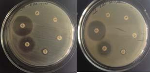 2. Detection of antibiotic resistance Disk diffusion method Agar dilution method Дэс дараалан шингэрүүлсэн антибиотикийг BHI агар (тархи зүрхний