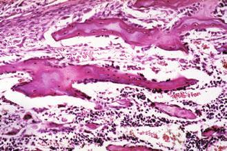 Οστεοκύτταρα σε βοθρία Εικόνα 5-6 (50x):