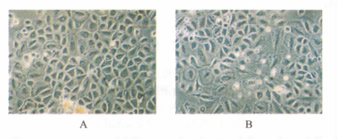 33 3 AGE-HSA 2. 8 AGE-HSA ECV304 Tab. 3 Comparison of cell cycle of primarily cultured ECV304 DMEM /F keratinocytes from AGEs and control groups 12 G 0 /G 1 /% S /% G 2 /M /% K-SFM 3 73. 16 ± 1.