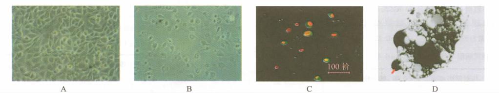 05 A K-SFM B 150 μg /ml AGE-HSA 200 7A 100 μg /ml AGE-HSA 48 h 7B Annexin V Fitc PI 7C ECV304 7D ECV304 12.