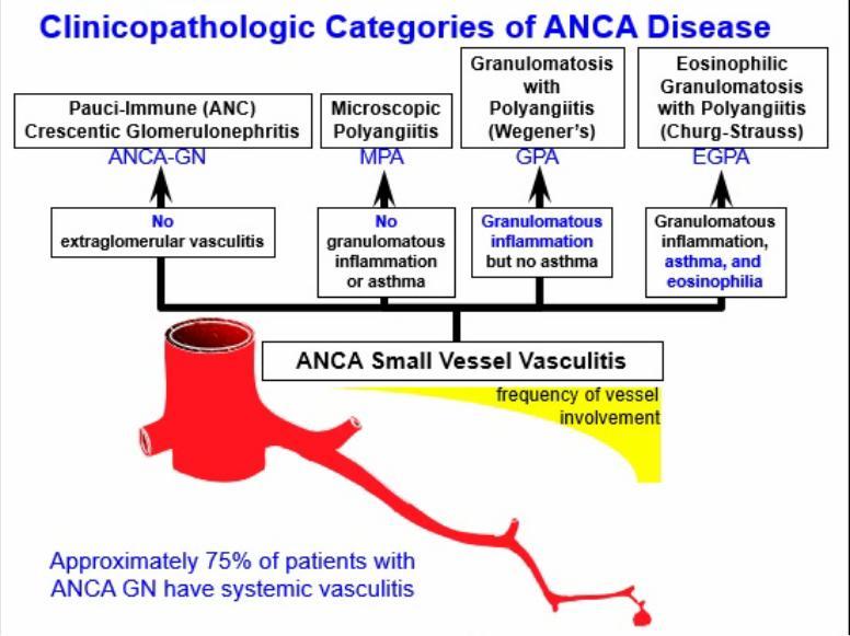 Jenette Arthritis Rheum 2012 Chapel Hill Consensus 2012 ANCA σχετιζόμενη αγγειίτιδα (AAV): Αυτοάνοσο νόσημα που