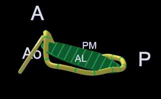 6 ± 3.6 mm vs 14.6 ± 1.6 mm, p<0.001 για την οπίσθια γλωχίνα). Μεταξύ των Ομάδων Ι και ΙΙ δεν παρατηρήθηκε διαφορά ως προς το μήκος των γλωχίνων (p=0.08 για την πρόσθια και p=0.