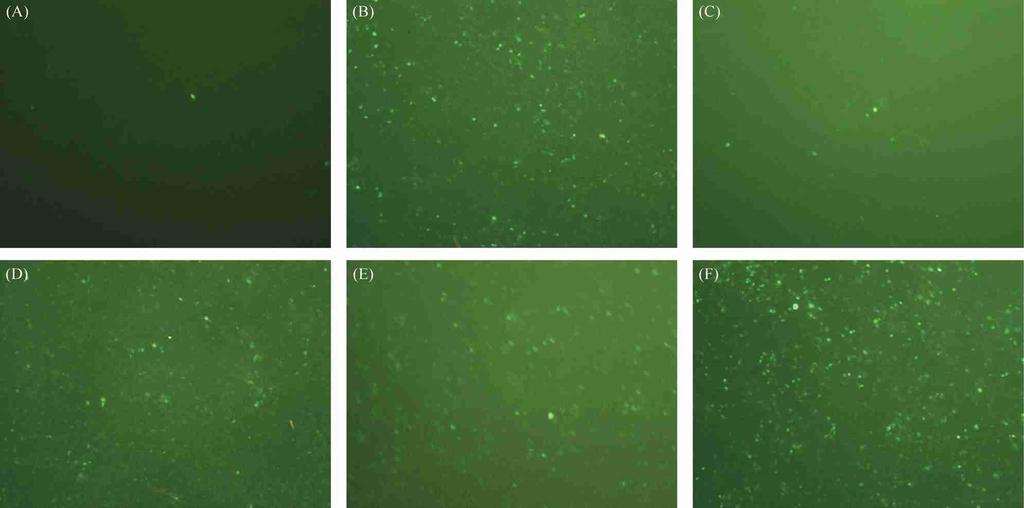 2 Expression of e GFP in each group at 5th day after the plasmids psos2ctgfi transfected into HEK293 cells ( 100) 018 g plasmids of psos2ctgfi in each group were mixed gently with 2 l lipo2fectamine