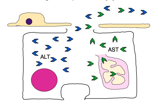 Τρανσαμινάσες Ευαίσθητοι δείκτες ηπατοκυτταρικής βλάβης Απελευθερώνονται στο πλάσμα με το θάνατο των ηπατοκυττάρων