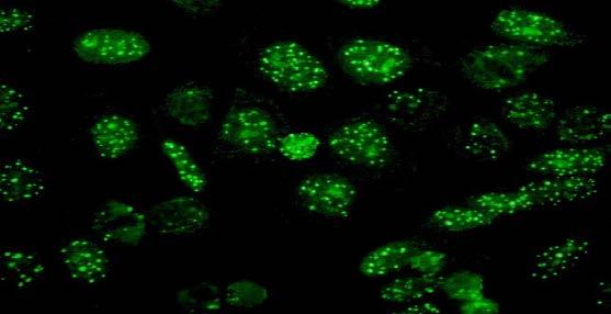 Diagn 2008. Ruffatti et al, J Clin Immunol 1985.