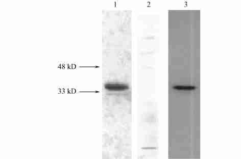 1 : Low M r protein marker ; 2 : HBsAg 116 mgπl (0170 10-7 molπl) ; SBP 5 mgπl,50 % A 492 HBsAg 114 mgπl (0161 10-7 molπl) ; SBP 10 mgπl,50 %A 492 HBsAg 1115 mgπl (0150 10-7 molπl).