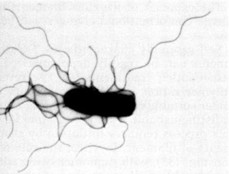 anaerobic gram negative rods)