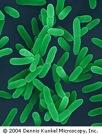 Yersinia spp Klebsiella Proteus