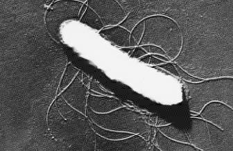 Παθογόνο στέλεχος της E.coli: Εντεροαιμορραγική Escherichia coli O157:H7 Στα εντεροβακτήρια έχουν χαρακτηριστεί >150 αντιγόνα Ο και >50 αντιγόνα Η Πχ Τα διάφορα παθογόνα στελέχη της E.