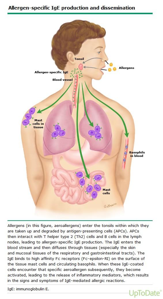 Allergeen + allergiline inimene