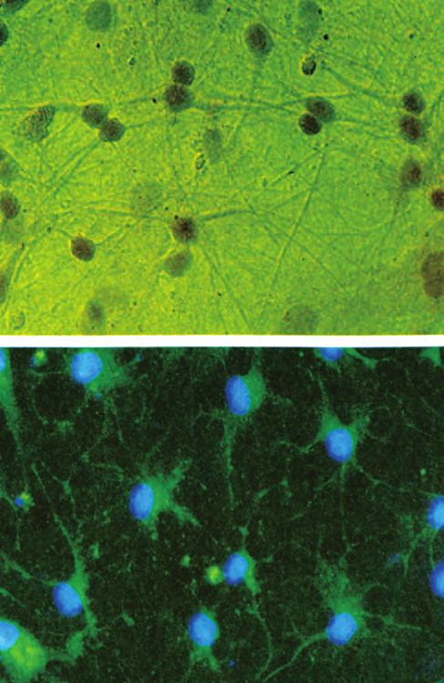 Νευρικά κύτταρα (φωτογραφίες από οπτικό μικροσκόπιο