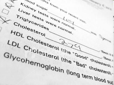 Čuli ste za HDL i LDL (šta je "dobar", a šta "loš" holesterol?