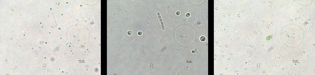 Slika : mikroskopiranje - potok, Algen Enocelične alge velikosti do 15 μm okroglih in jajčastih oblik,