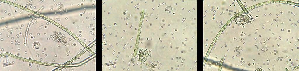 Algen Enocelične alge velikosti do 15 μm med drugimi tudi alge z rodu Chlorella.