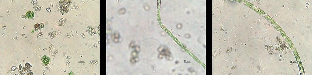 Slika : mikroskopiranje - luža, šola Okrogle algne tvorbe velikosti približno 20 μm, enocelične alge in makroalge debeline od 10 do 15 μm.