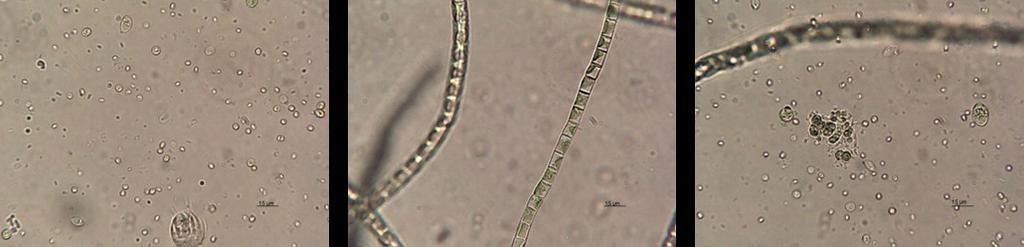 oblik, okrogle algne tvorbe (slika levo) in makroalge debeline do 10 μm.