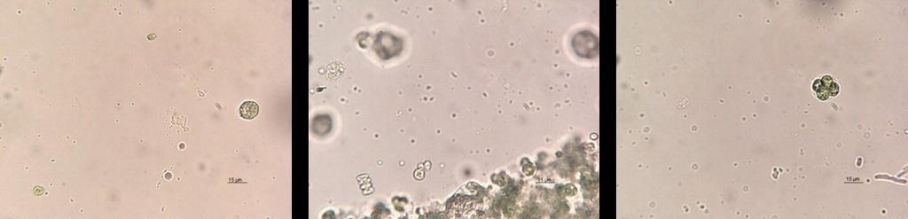 Slika : mikroskopiranje - negativna kontrola izhod Prisotne so različne vrste mikroalg med